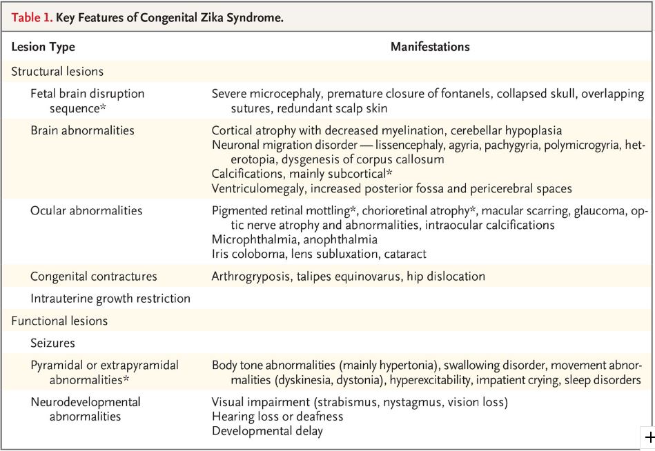 Key Features of Congenital Zika Syndrome