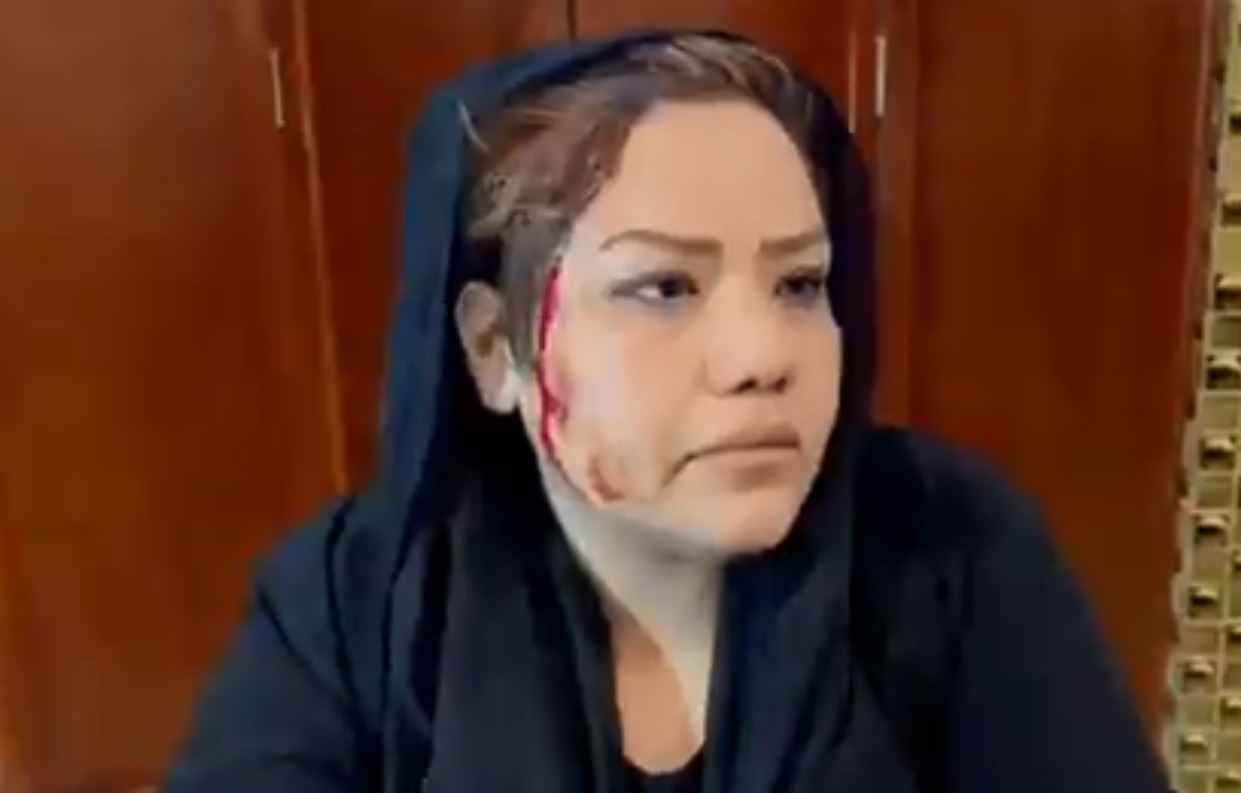 Women Protest in Kabul Afghanistan taliban  Rabia Sadat one of the today’s protestor