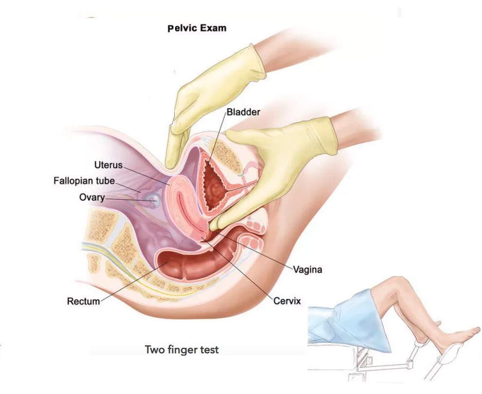 Two finger virginity test