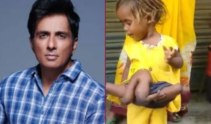 Bollywood actor Sonu Sood , Baby girl born with four arms and legs